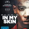 In my Skin